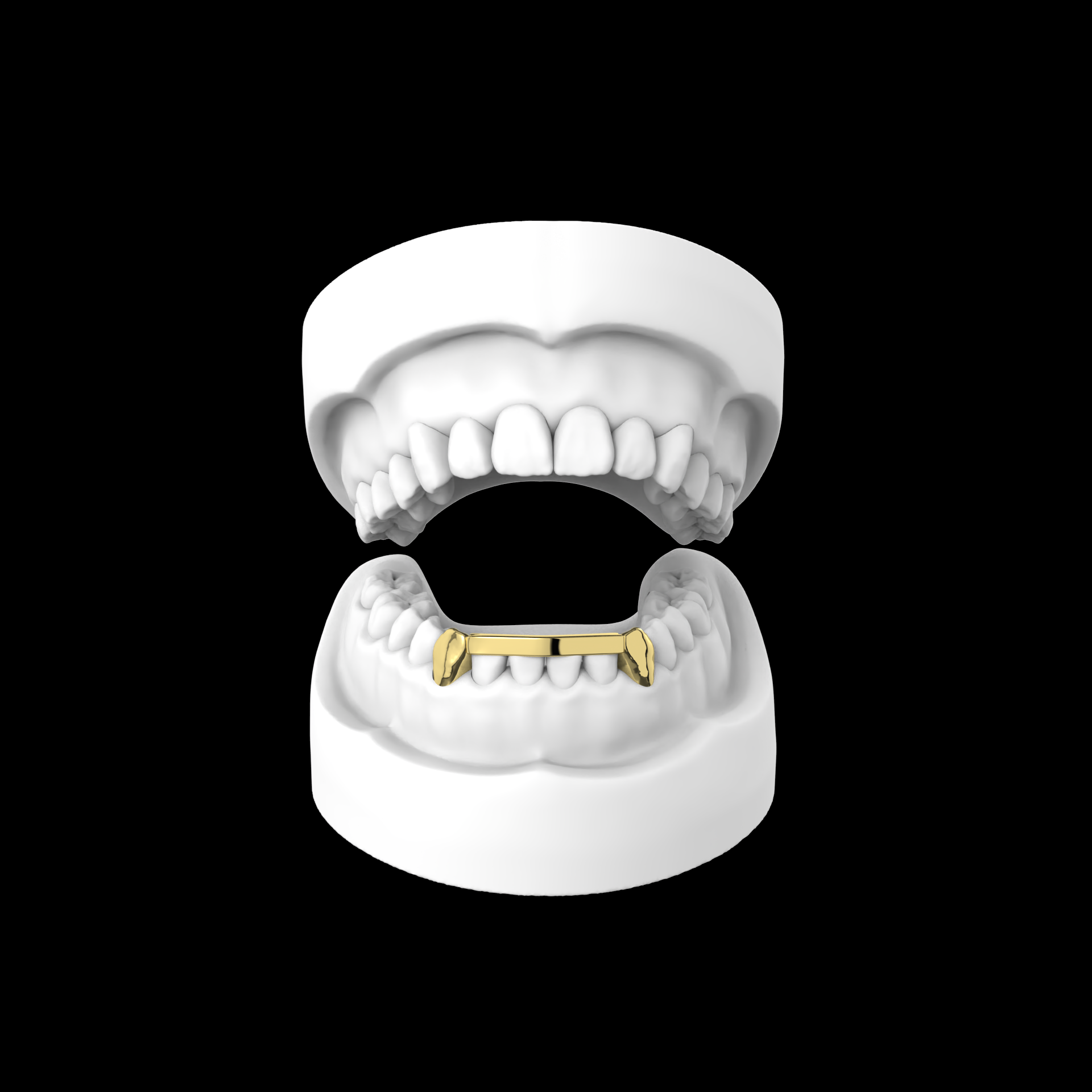 London Bridge Grillz