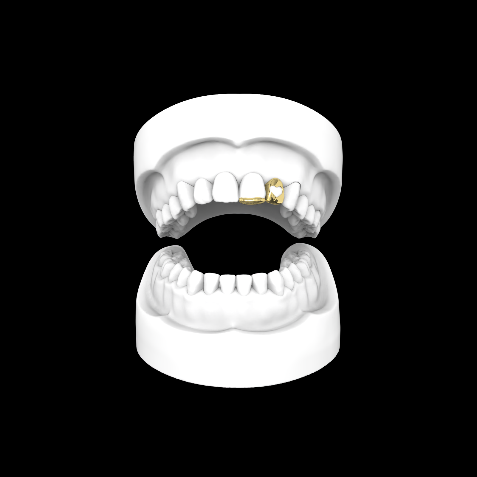 Inlay + Open Face Heart