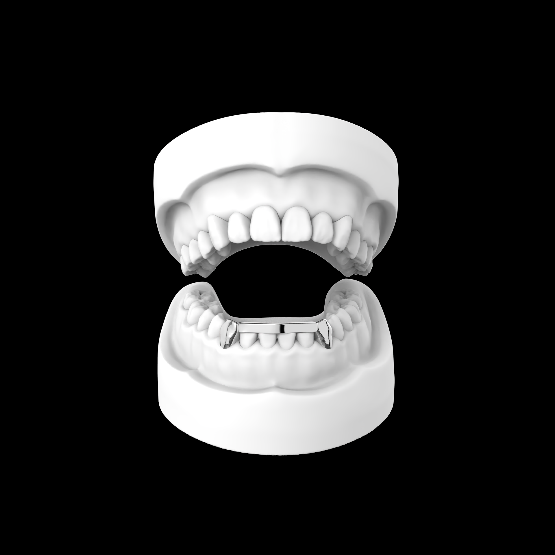 London Bridge Grillz