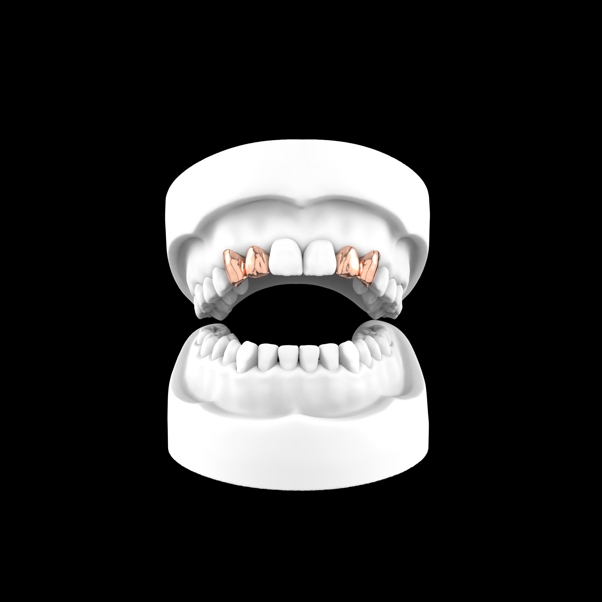 Set Of 4 Grillz