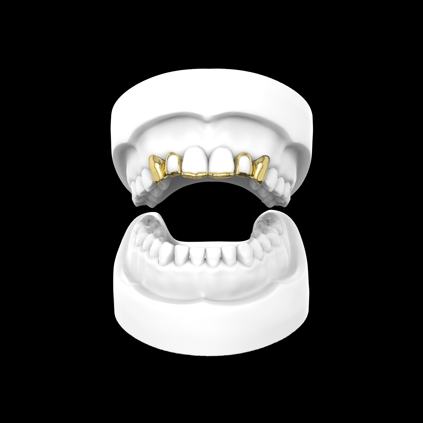 X6 Grillz - (window + Inlay)