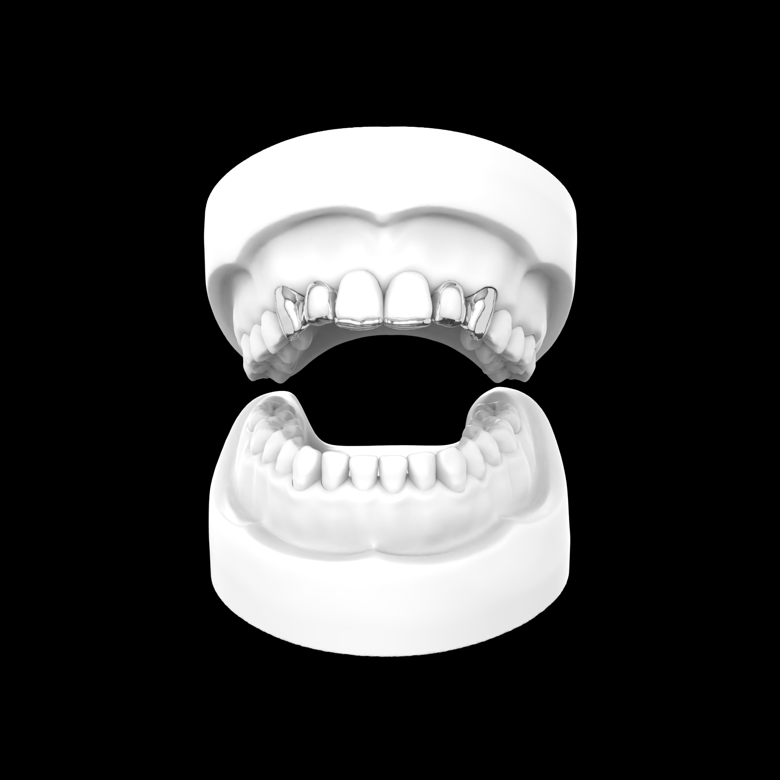 X6 Grillz - (window + Inlay)