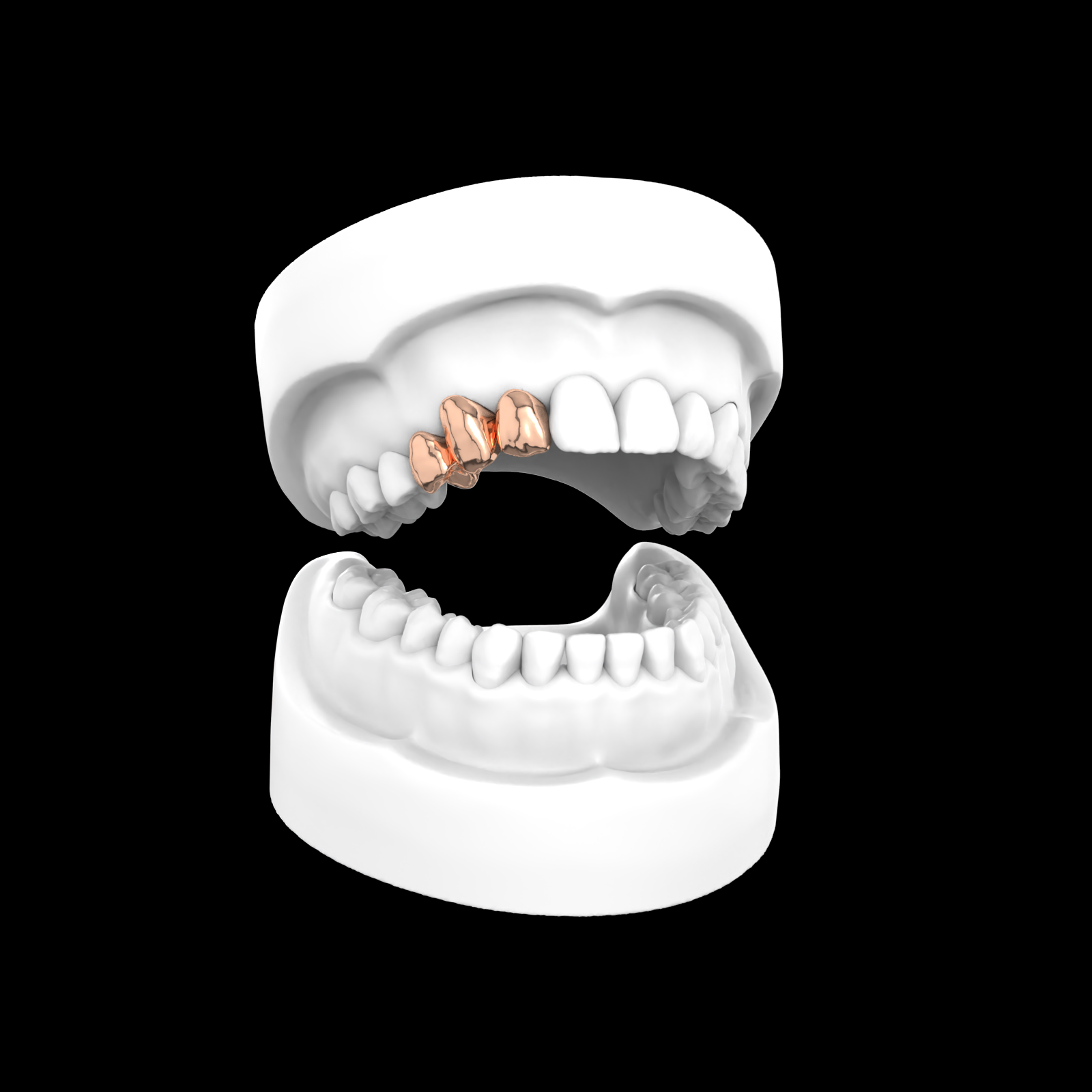Set Of 3 Grillz