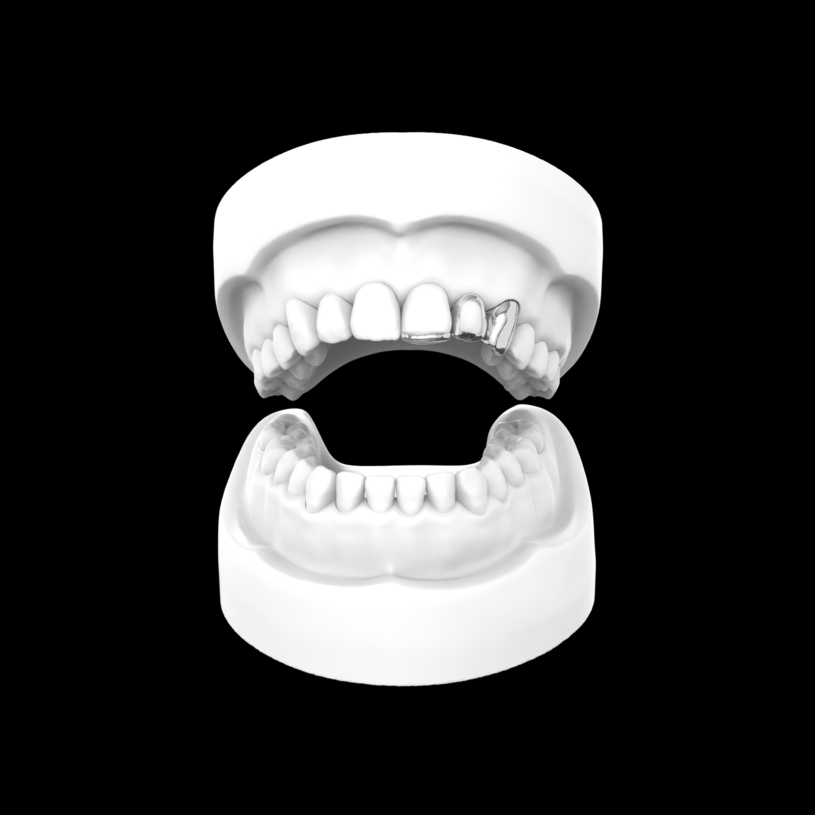 x3 Grillz (Inlay + Window)
