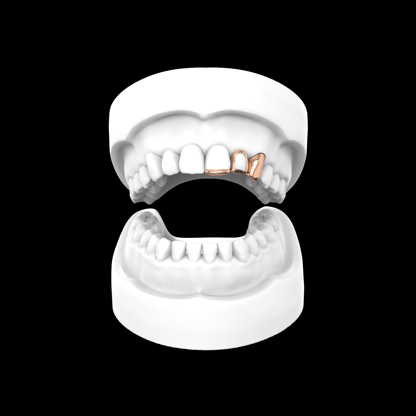 x3 Grillz (Inlay + Window)