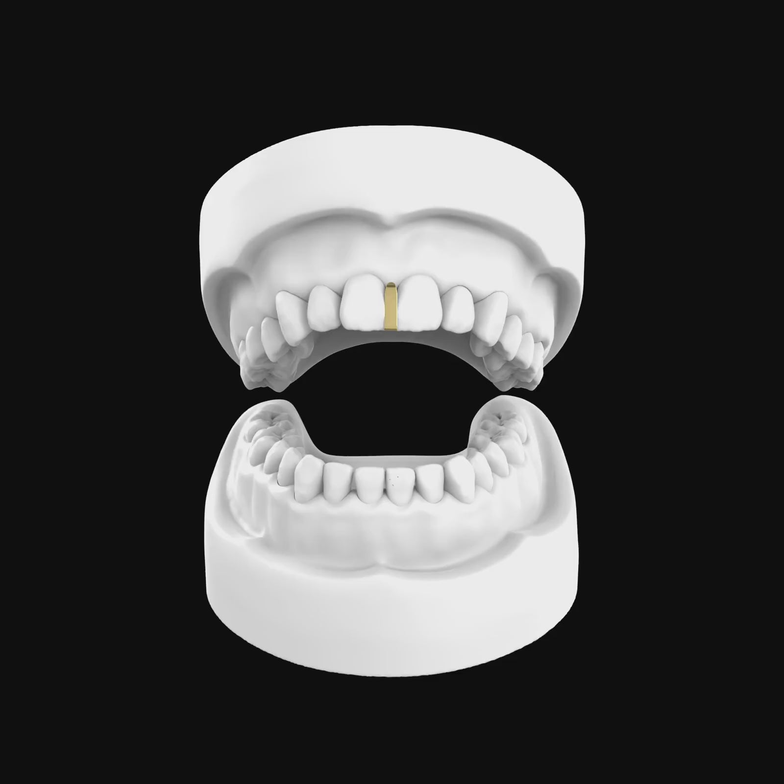 Load video: Gap Filler