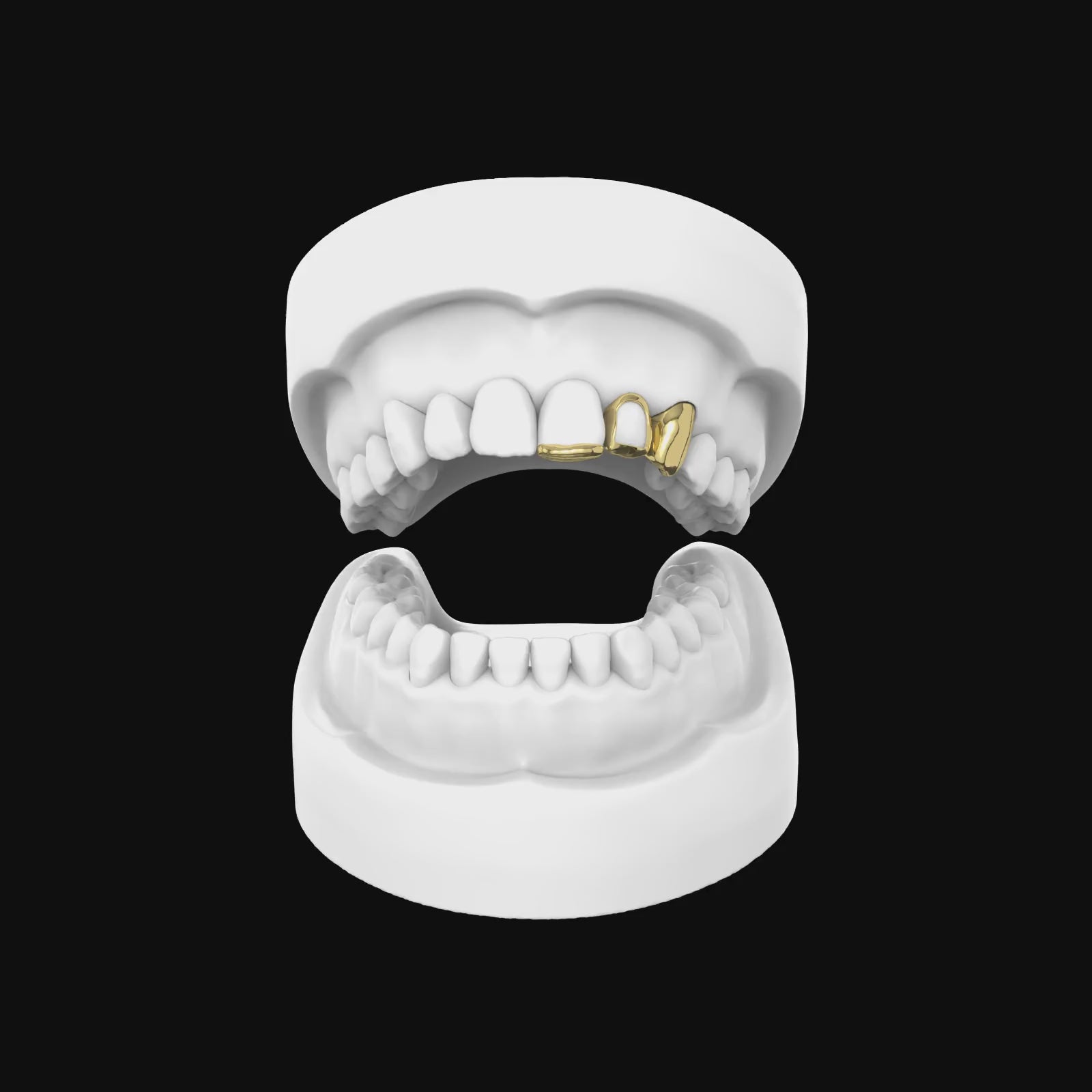 Load video: x3 Grillz (Inlay + Window)